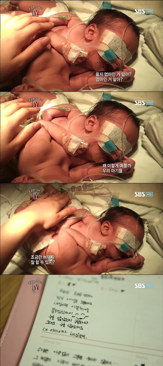 궁금한이야기 Y 샴쌍둥이 이야기 | 인스티즈