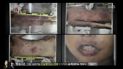 박근혜피습사건형량이랑 다른사건 형량차이봐(잔인한사진주의) | 인스티즈