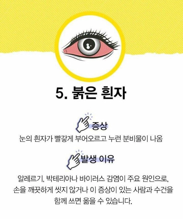 눈으로 알 수 있는 질병 | 인스티즈