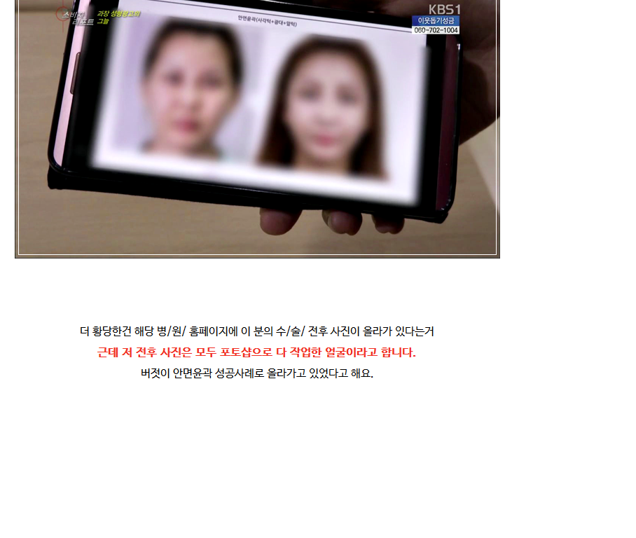 성형 과장광고 & 전후사진 모두 보정가짜 속지맙시다.jpg | 인스티즈