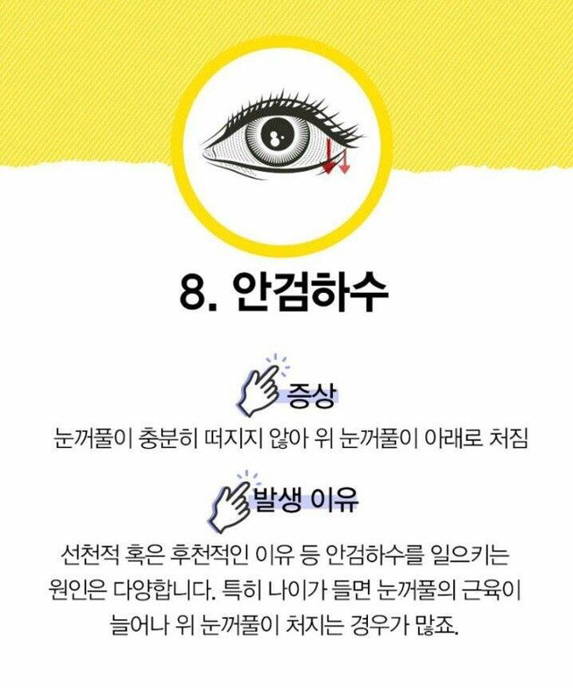 눈으로 알 수 있는 질병 | 인스티즈
