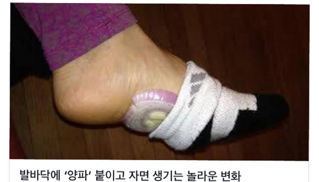 발바닥에 '양파' 붙이고 자면 생기는 놀라운 변화 | 인스티즈