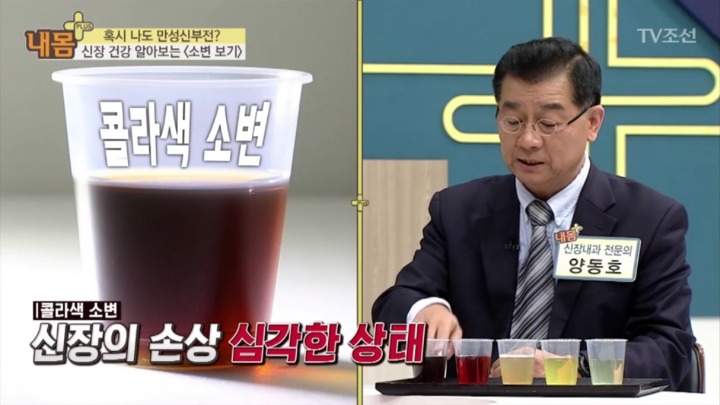 소변 색으로 보는 신장 건강 | 인스티즈