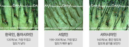 동양인이 서양인처럼 수염안자라나는 이유 | 인스티즈