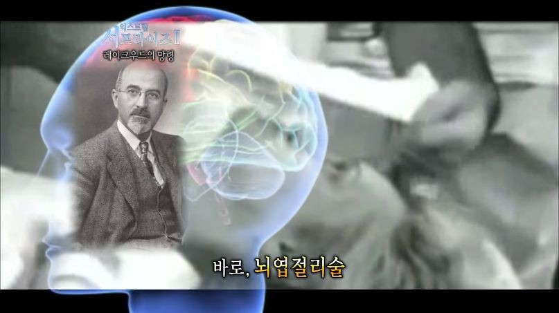 [서프라이즈] 잘못된 수술 레이크우드의 망령.jpg | 인스티즈