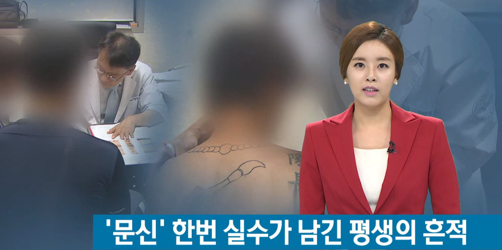 문신, 이제 지우고 싶어요! | 인스티즈