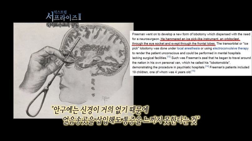 [서프라이즈] 잘못된 수술 레이크우드의 망령.jpg | 인스티즈
